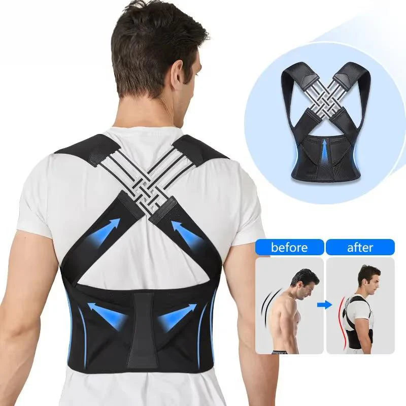 Ayarlanabilir Ergonomik Duruş Düzeltici – Tüm Gün Destek